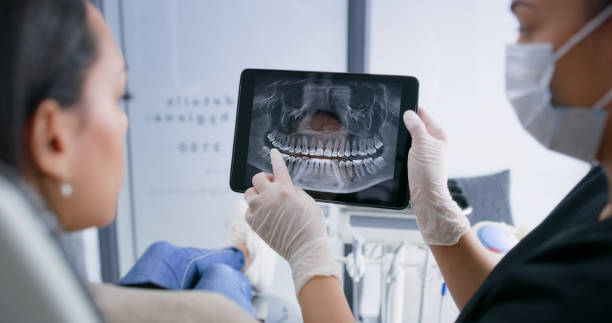 Licensed Wisdom Tooth Removal service in Dunwoody, GA - Smile Center Dentistry